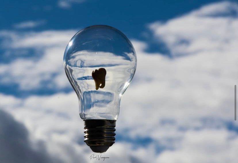 На що варто звертати увагу при виборі стоматологічних борів?