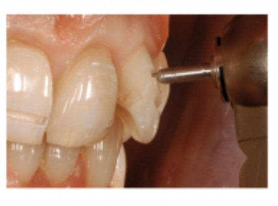 Маркувальний бор Depth Marker OkoDent